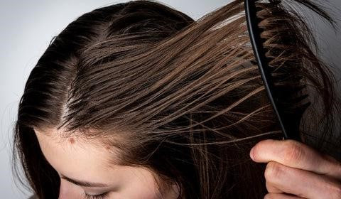 Treating & Rebalancing Greasy Scalp: Causes and Remedies